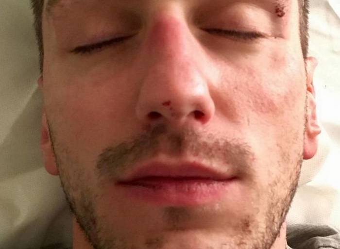 Agression homophobe à Lyon