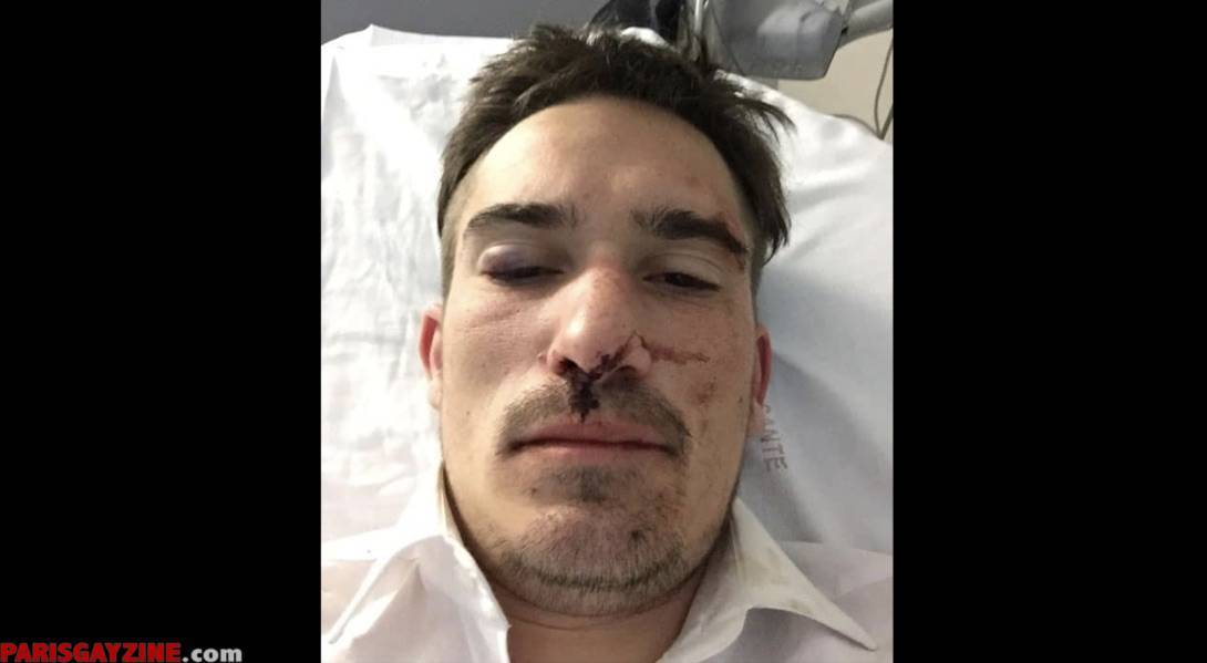 Une des victimes de l'agression (c) Le Girofard